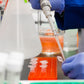 Small Intestinal Bacterial Overgrowth Test (Glucose)